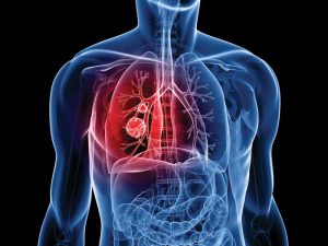 Insulating commercial facilities against dangerous radon gass